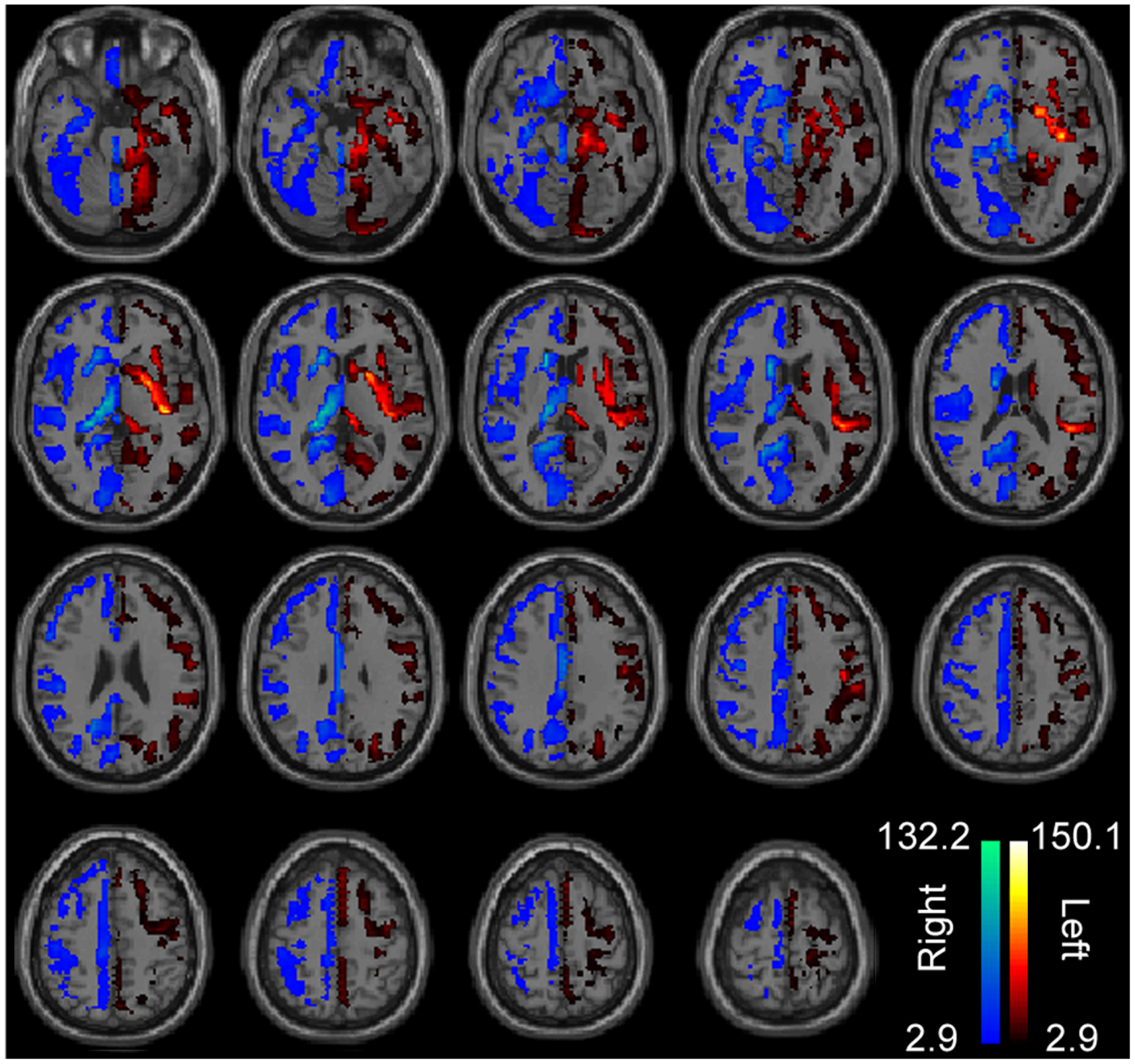 Left brain, right brain?
